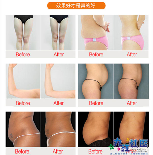 极立瘦效果图.jpg